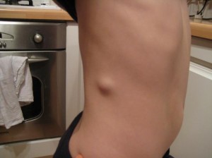 Lump Lump