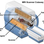 mri-scanner-cutaway